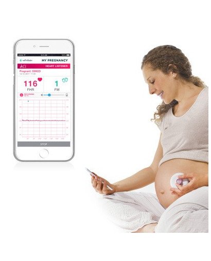 ESCUCHALATIDOS SWEETBEAT MINILAND